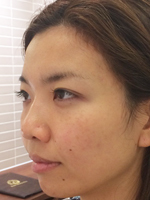 透明感・目力がアップ! “疲れ顔”から脱却