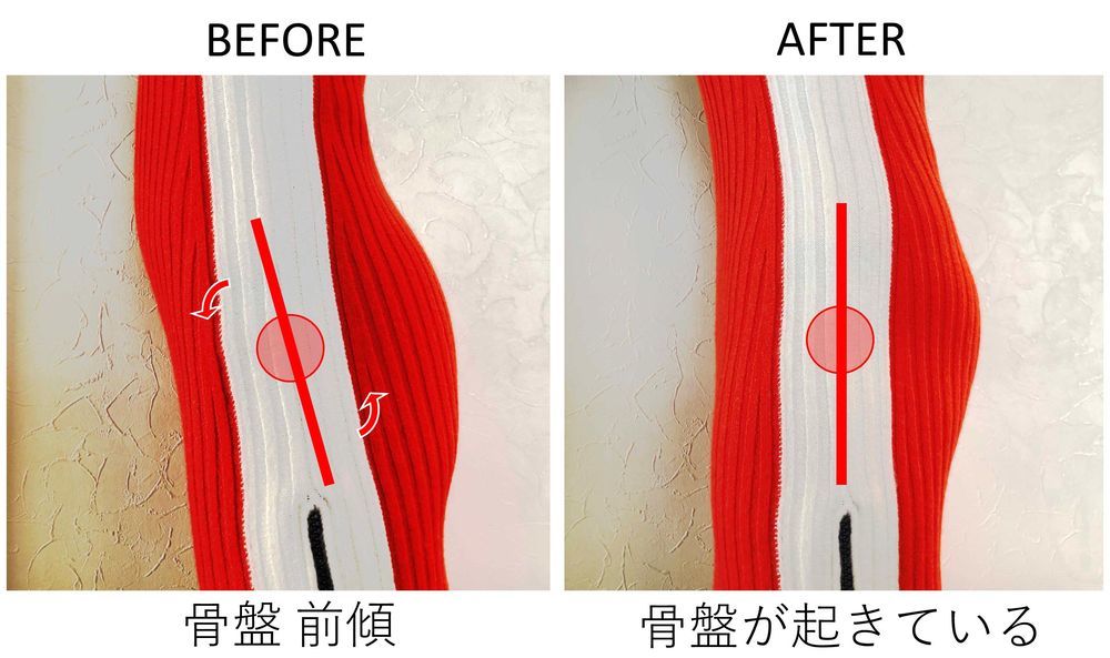横に広がり気味だったお尻が、骨盤を立てることでキュッと上がり丸みを帯びた美尻に!