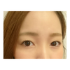 20170805212816.png by ݂ۂ񂽂܂邳