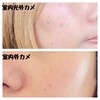 2025-03-14 15:08:11 by ݂񂭂낳