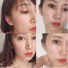 2018-08-09 19:51:18 by t.s