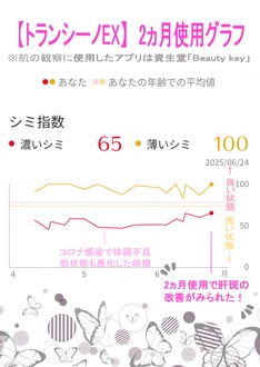 肝斑 の画像