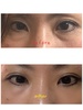 GNV[ / GNV[ VyG `mp[ NN[iby ~gO[j