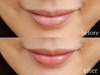 2024-09-24 11:22:48 by ݂549